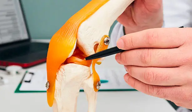 Medical illustration showing tendon inflammation (tendinitis) in a joint