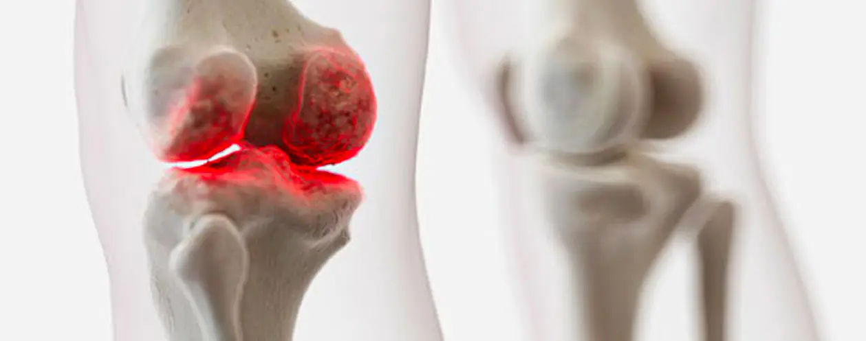 Diagnostic imaging used to evaluate a knee condition