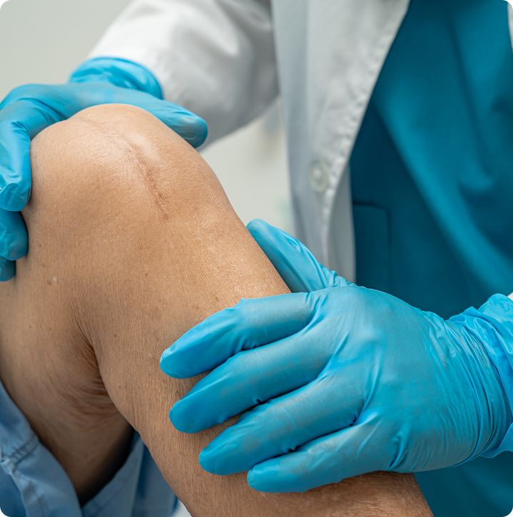 A patient recovering after a knee replacement surgery