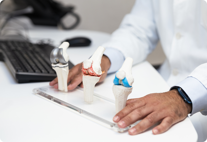 A doctor displaying several knee replacement options