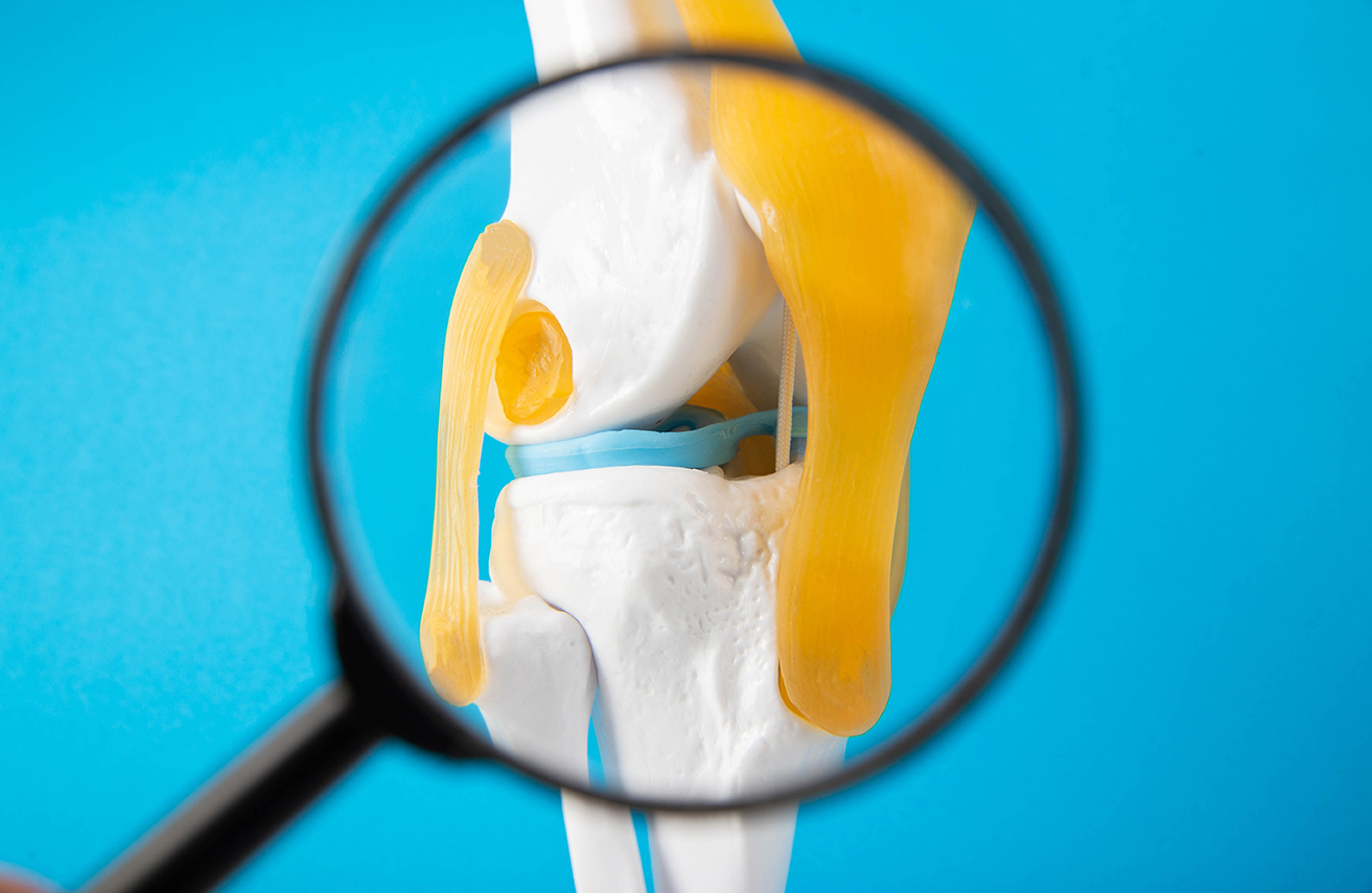 A close-up of knee cartilage.
