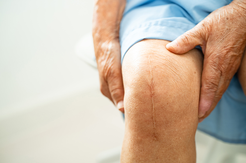 An elderly woman recovering from surgery at a knee clinic