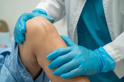 Knee Replacement Surgery